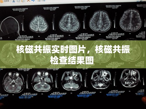 核磁共振实时图片,核磁共振检查结果图