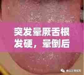 突发晕厥舌根发硬,晕倒后舌头伸出来发紫