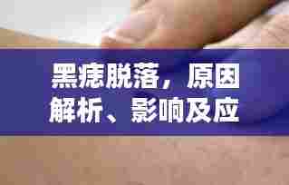 黑痣脱落,原因解析、影响及应对方案一网打尽!