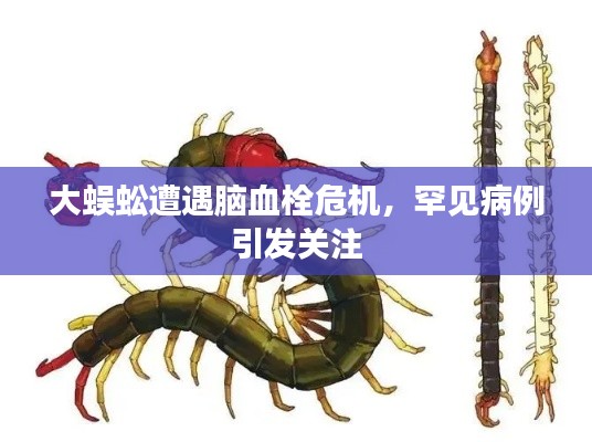 大蜈蚣遭遇脑血栓危机，罕见病例引发关注